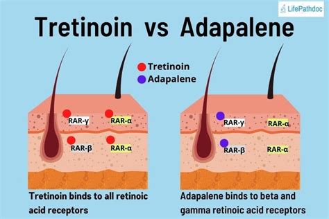 Other common retinoids include adapalene, retinaldehyde, and isotretinoin. . Adapalene vs retinaldehyde
